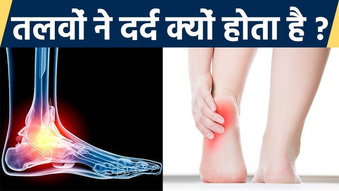 *लंबे समय तक खड़े रहने, गलत जूते पहनने, नसों में सूजन