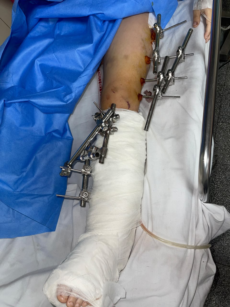 स्कूल छोड़ने जा रही मां और मासूम बेटे को तेज रफ्तार कार ने मारी टक्कर, कई मीटर दूर जाकर गिरे दोनों; सेक्टर-20 थाने में मामला दर्ज, पुलिस की जांच जारी — आखिर कब थमेगा सड़कों पर तेज रफ्तार का आतंक?
